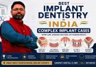 Best Implant Dentistry in India: Complex Implant Cases